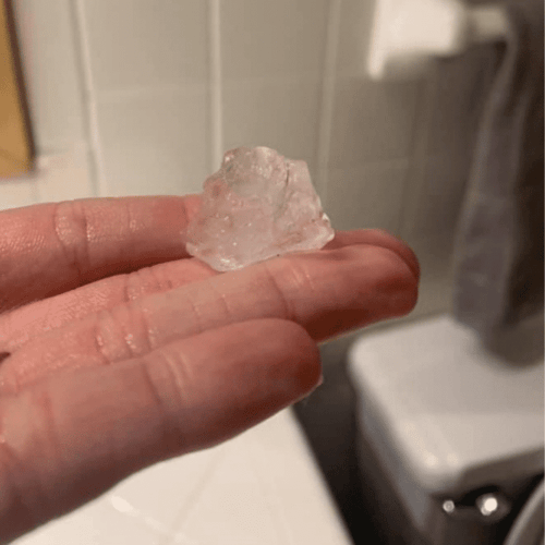 hail that will cause roof damage